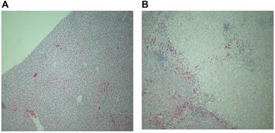 The Genomic Architecture of Fowl Typhoid Resistance in Commercial Layers